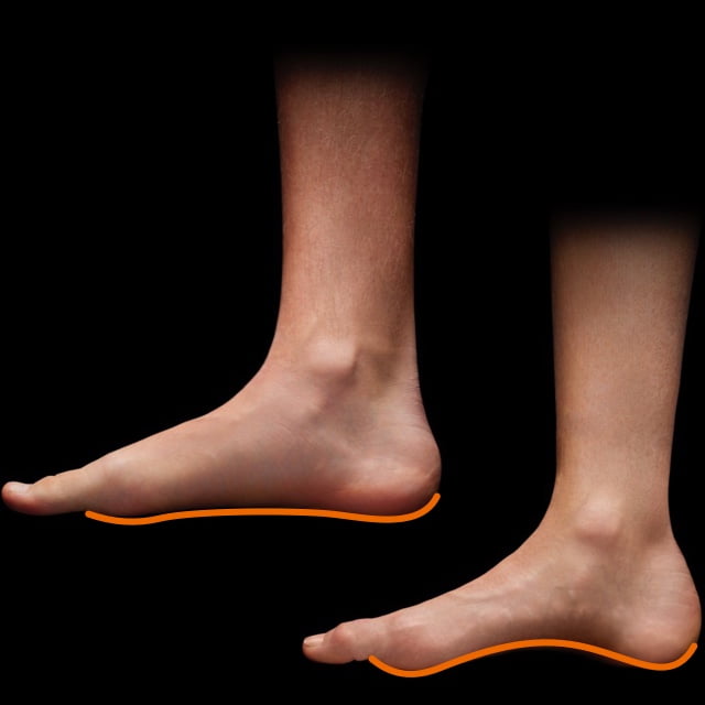 HIGHER FOOT ARCH
